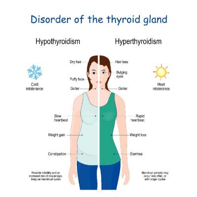 nutrition hypothyroide